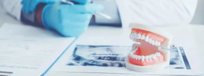 stock photo of dentures on a table